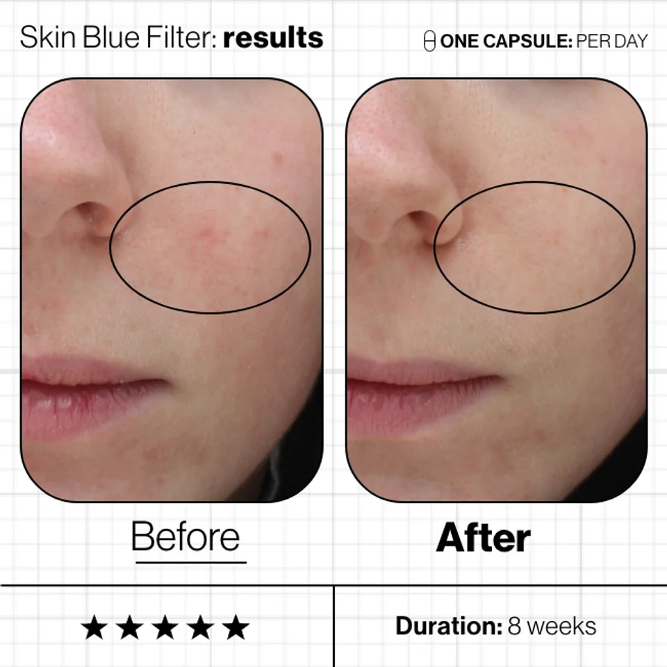Advanced Nutrition Programme Skin Blue Filter - Image 4
