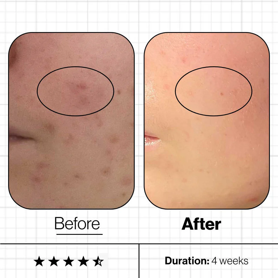 Advanced Nutrition Programme Skin Clear Biome - Image 3