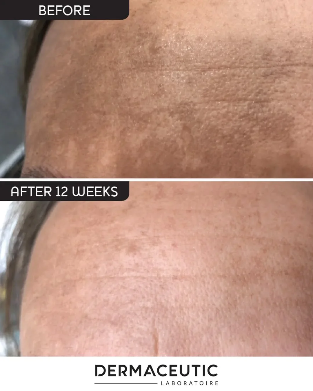 Dermaceutic Mela Cream - Image 3