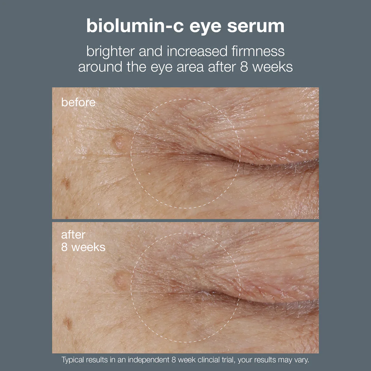 Dermalogica BioLumin-C Eye Serum - Image 5