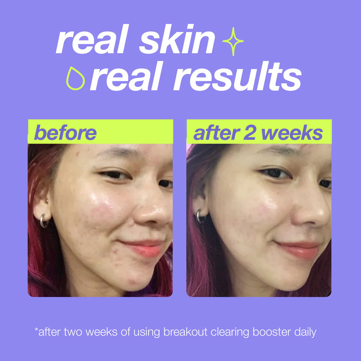 Dermalogica Breakout Clearing Booster 30ml - Image 6