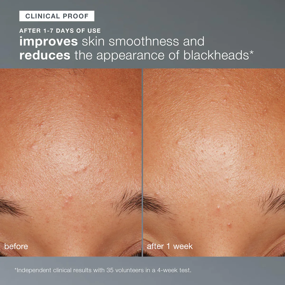 Dermalogica Daily Microfoliant - Image 4