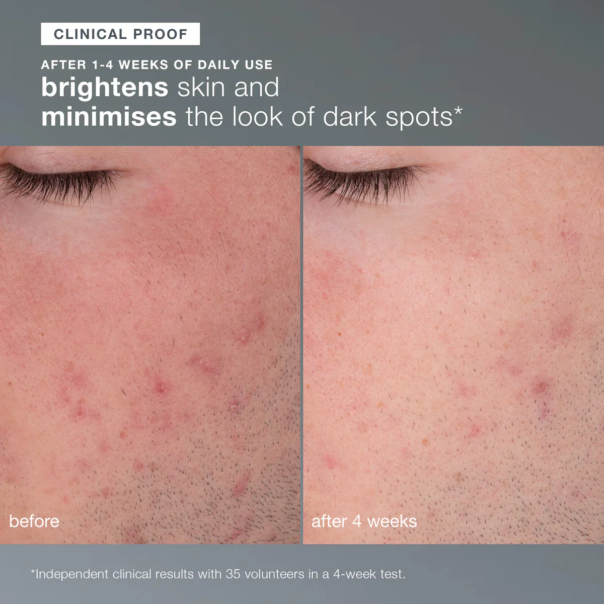 Dermalogica Daily Microfoliant - Image 5