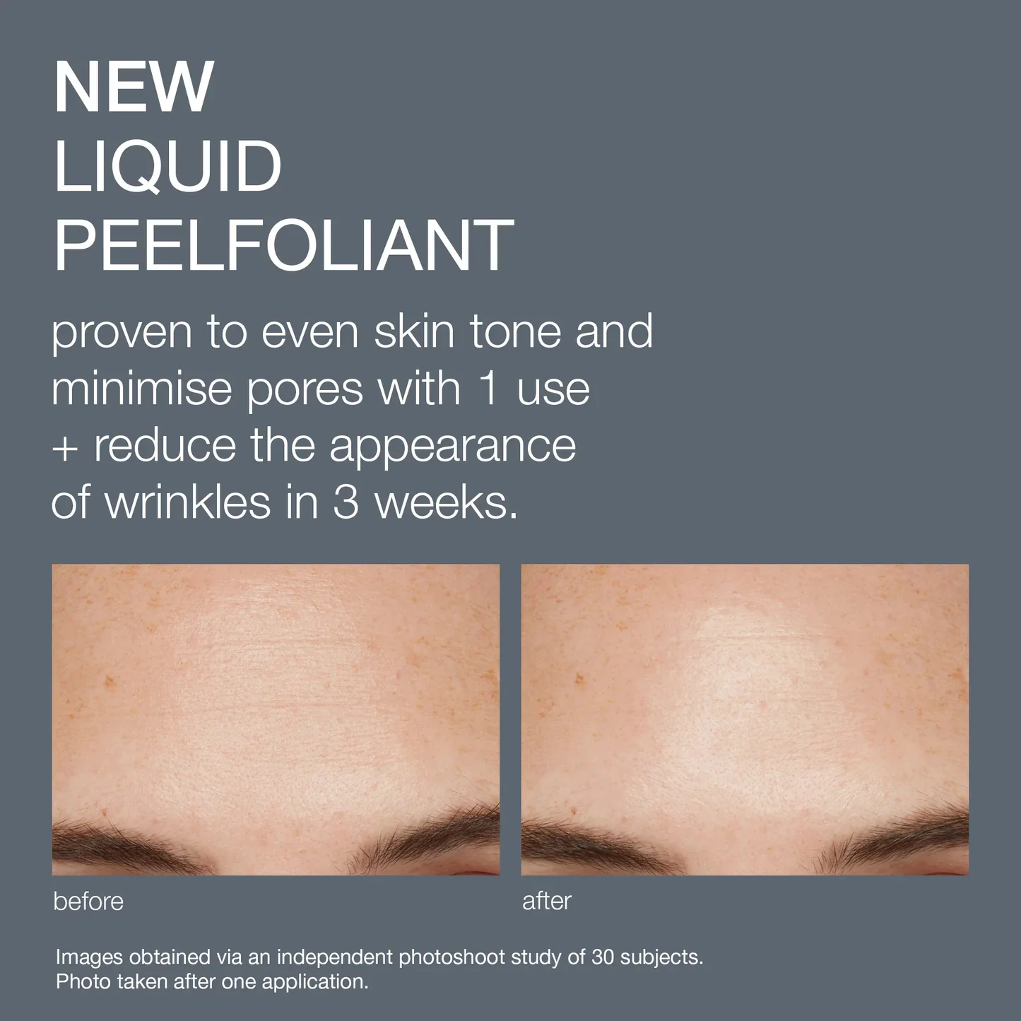 Dermalogica Liquid Peelfoliant 59ml - Image 2