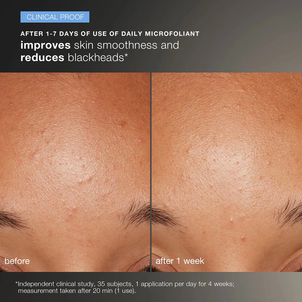 Dermalogica Discover Healthy Skin Kit - Image 7