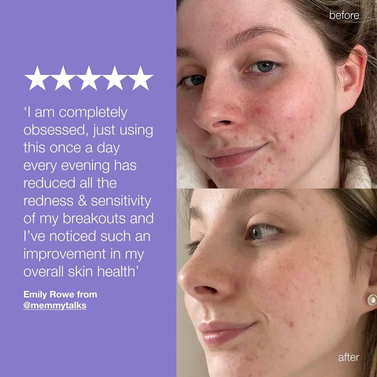 Dermalogica Stabilizing Repair Cream - Image 6
