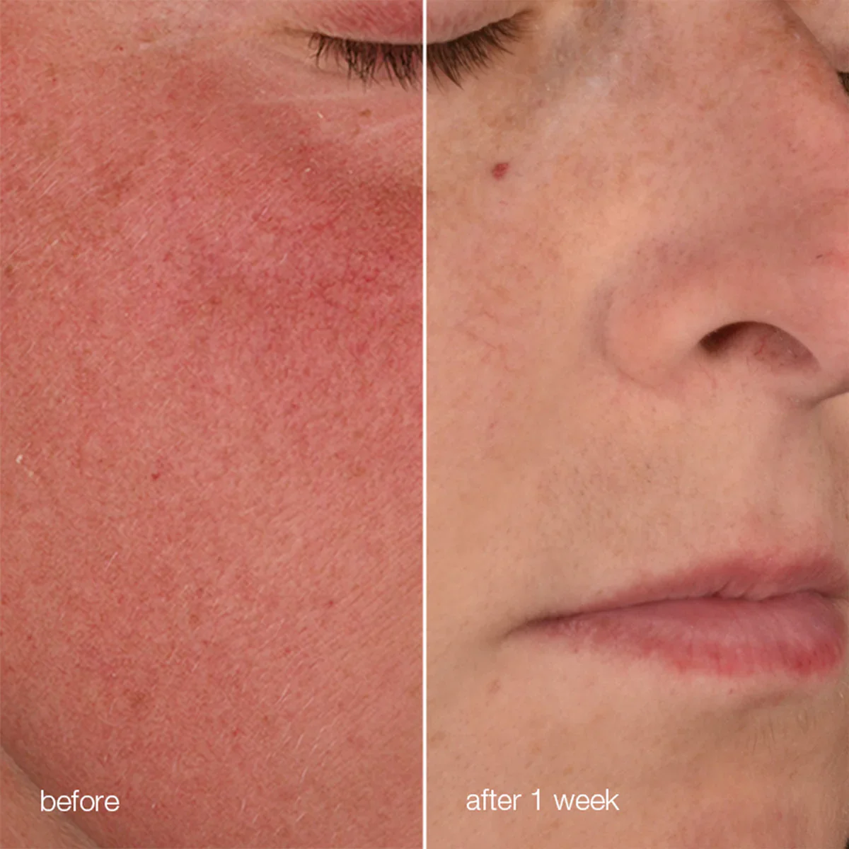 Dermalogica Stabilizing Repair Cream - Image 7