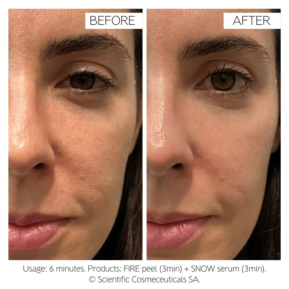 Dr Levy Fire & Snow Peel & Serum - Image 3