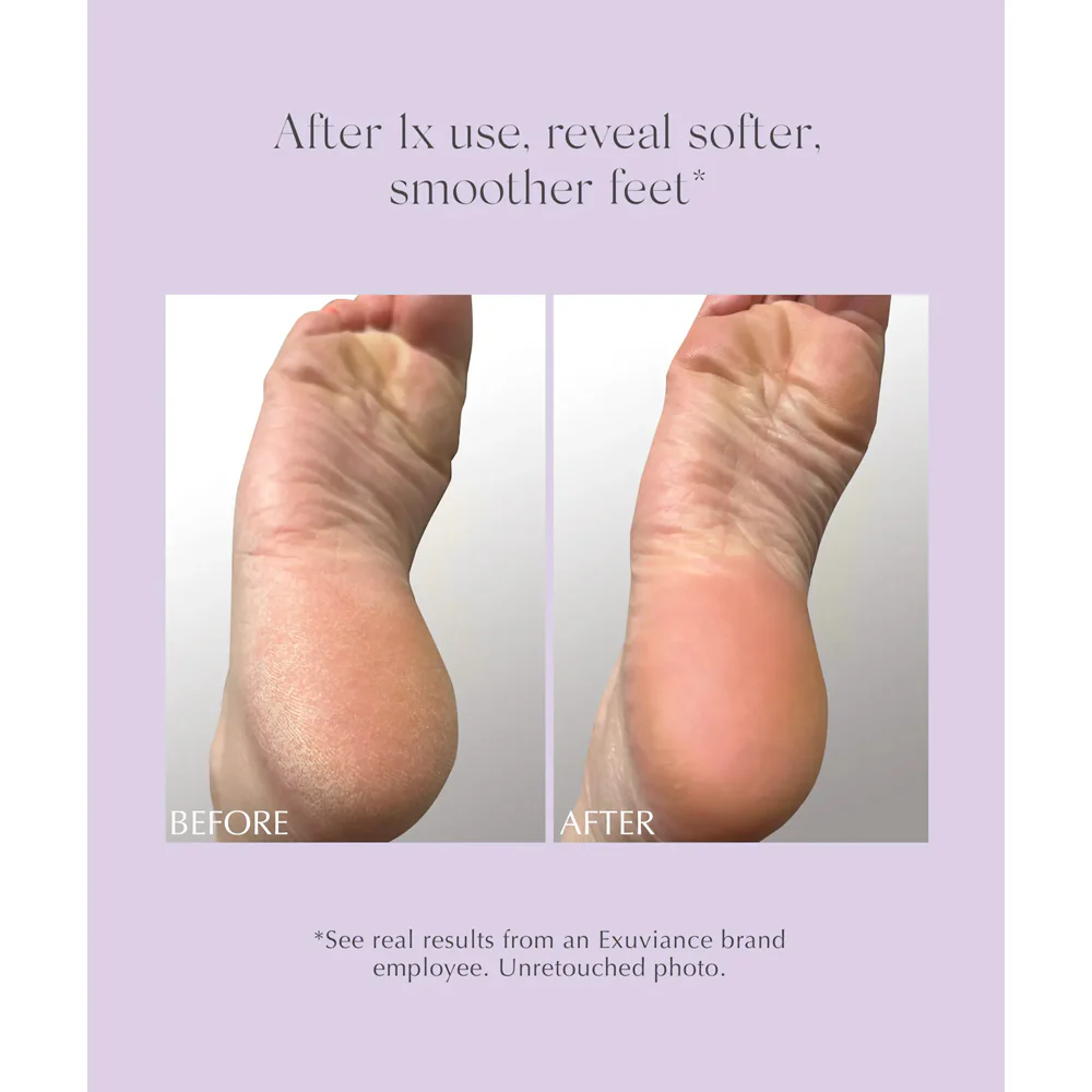 Exuviance Exfoliating & Conditioning Foot Balm - Image 5