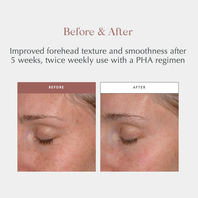 Exuviance Performance Peel AP25 26 pads - Image 2