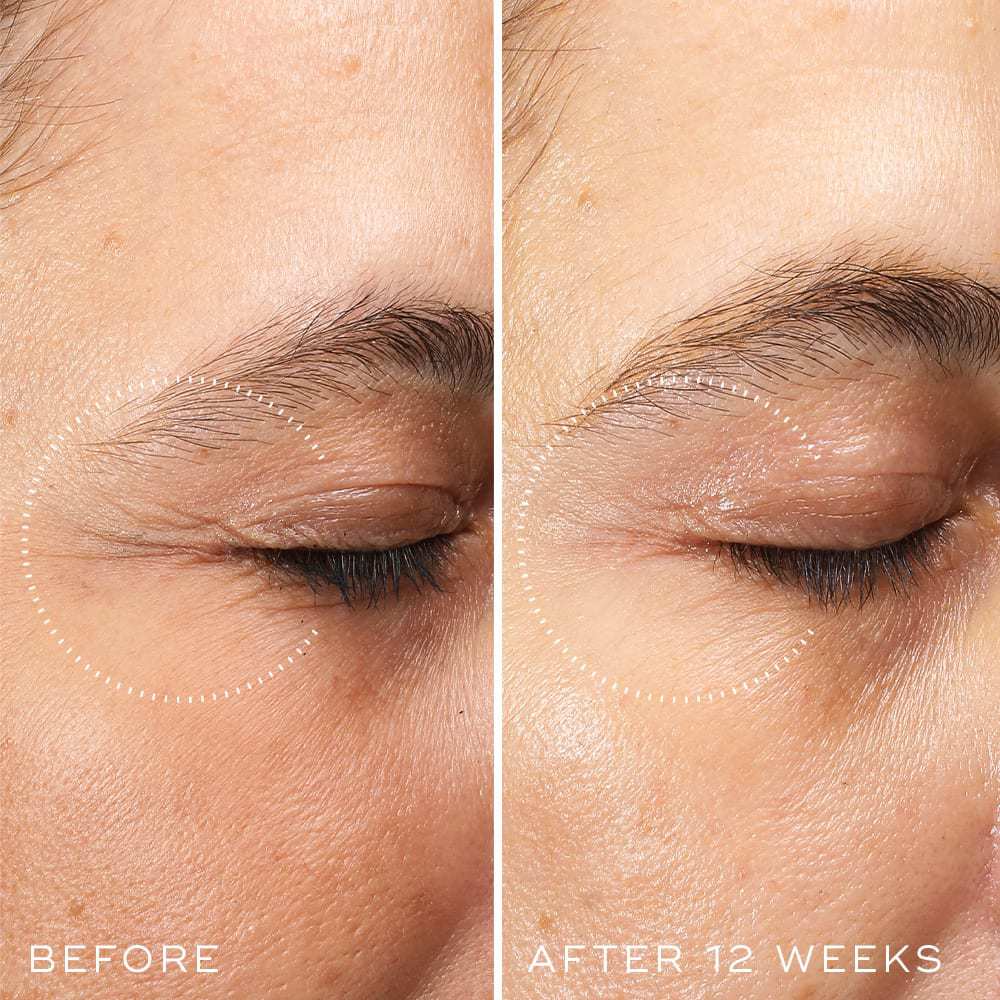 Medik8 Crystal Retinal Ceramide Eye 3 - Image 10