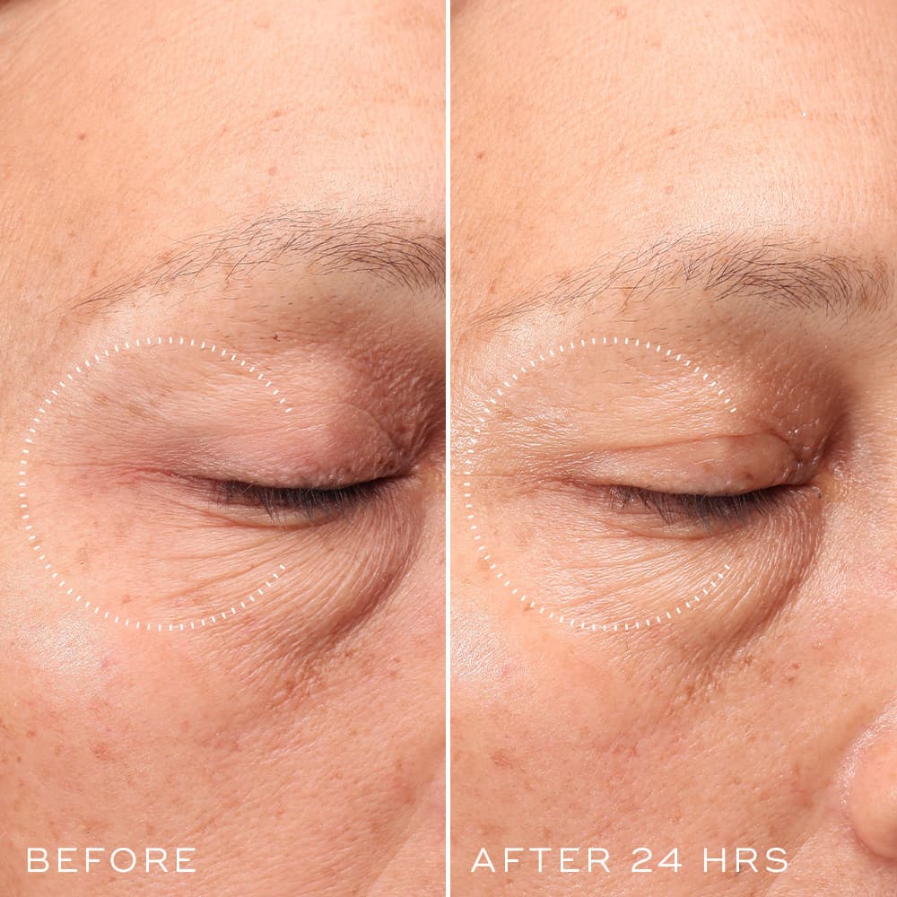 Medik8 Crystal Retinal Ceramide Eye 3 - Image 9