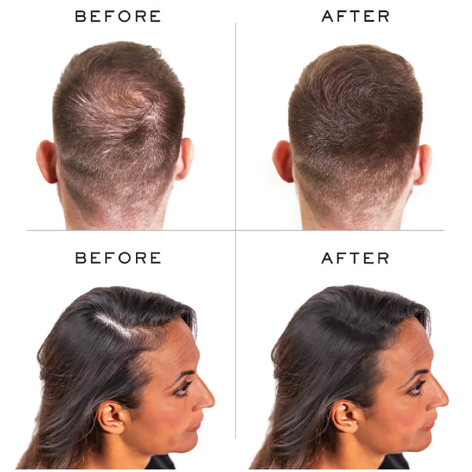 Nanogen Keratin Hair Fibres - Image 4
