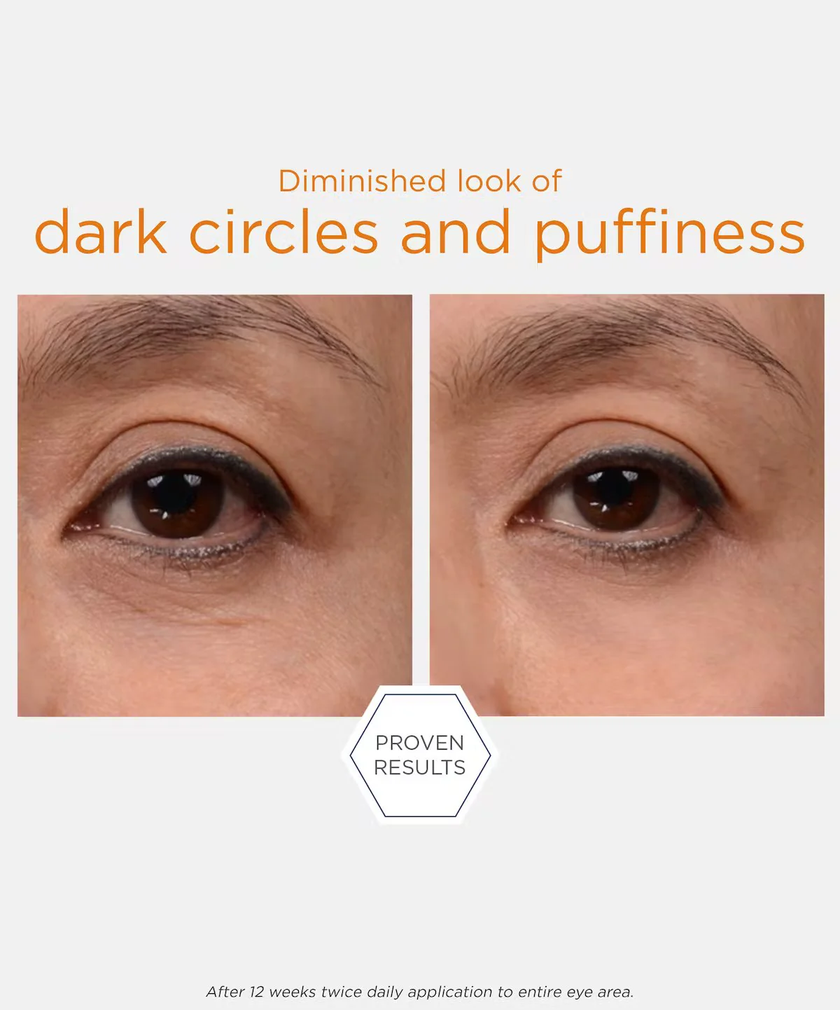 NeoStrata Enlighten Brightening Eye Cream - Image 4