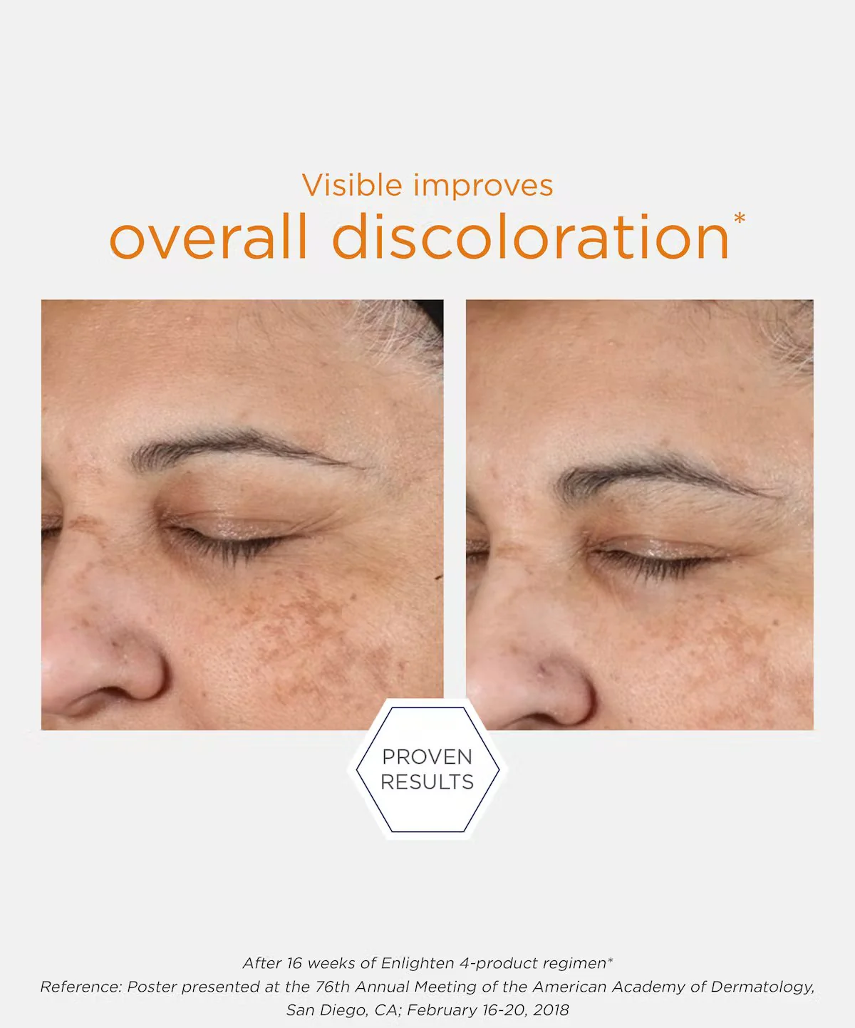 NeoStrata Enlighten Illuminating Serum - Image 4