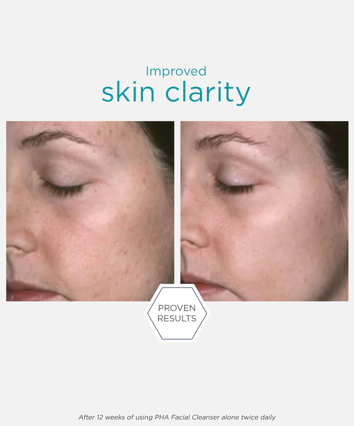 NeoStrata Restore Bionic Face Cream - Image 5