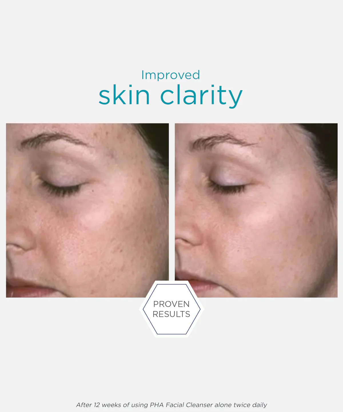 NeoStrata Restore PHA Facial Cleanser - Image 6