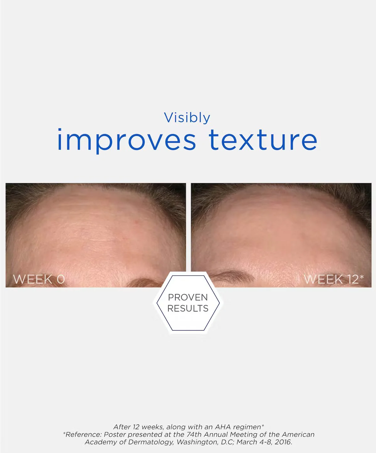 NeoStrata Resurface Smooth Surface Glycolic Peel - Image 2