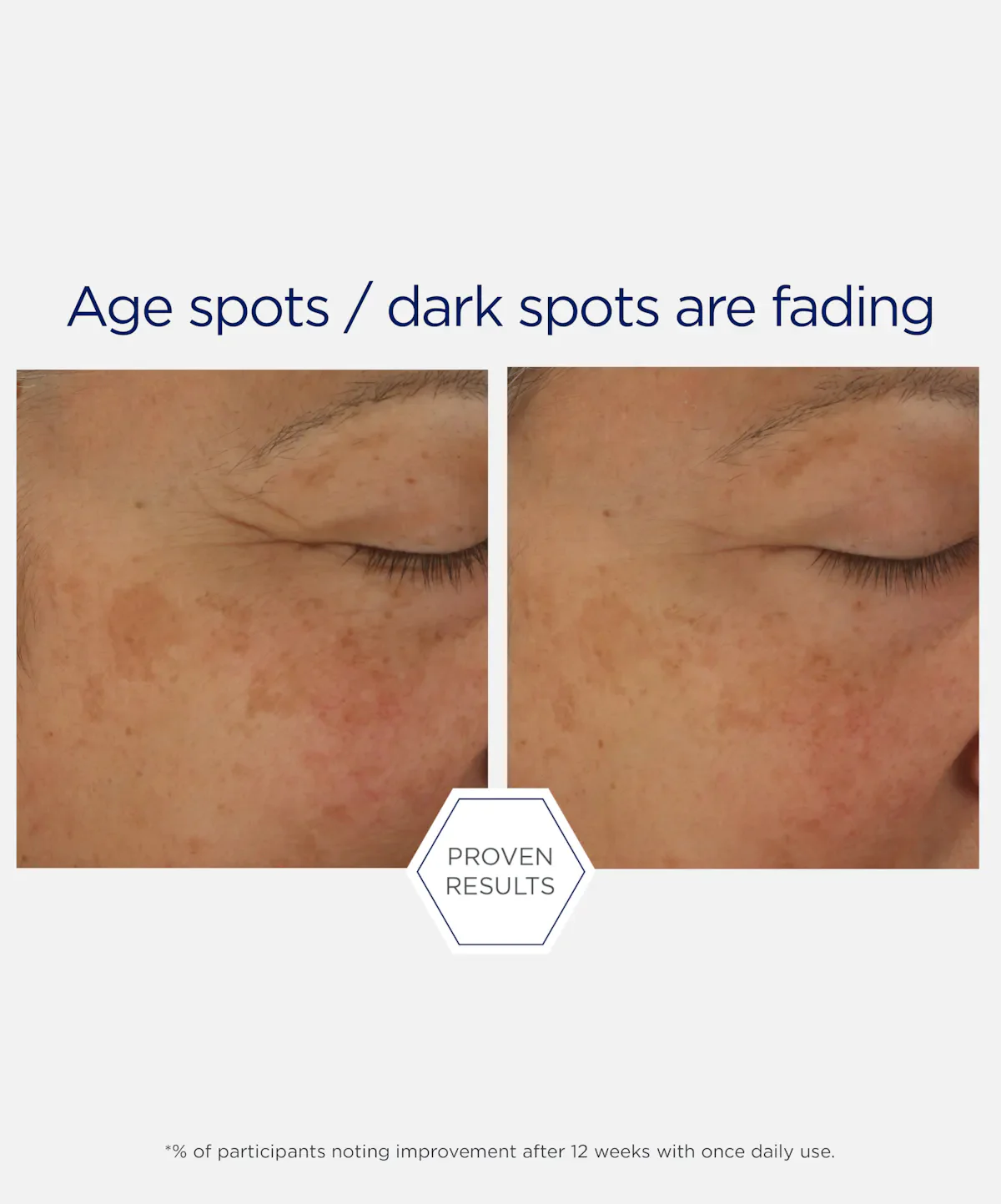 NeoStrata Skin Active Firming Potent Retinol Complex - Image 5
