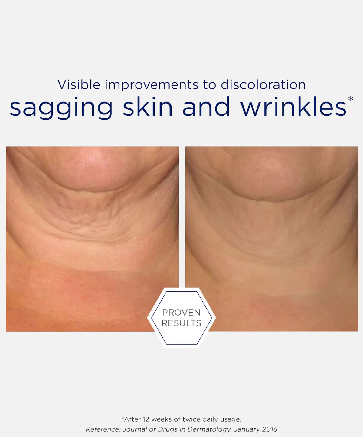 NeoStrata Skin Active Triple Firming Neck Cream - Image 6